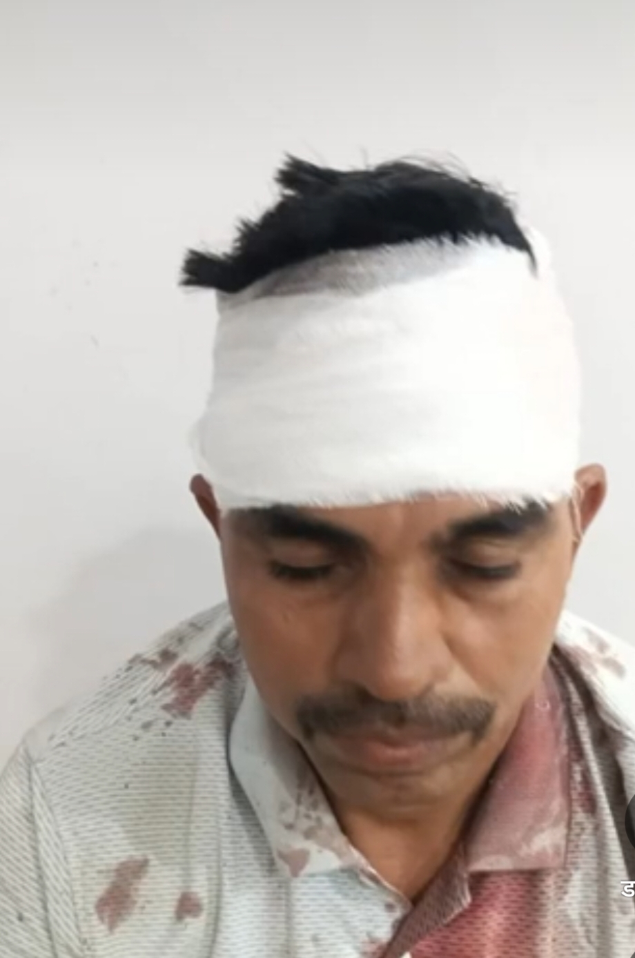 बेख़ौफ अपराधी,सुस्त पुलिस,लूट की नीयत से व्यापारी पर तीन नकाबपोश बदमाशों ने किया हमला,व्यापारी गंभीर रूप से घायल