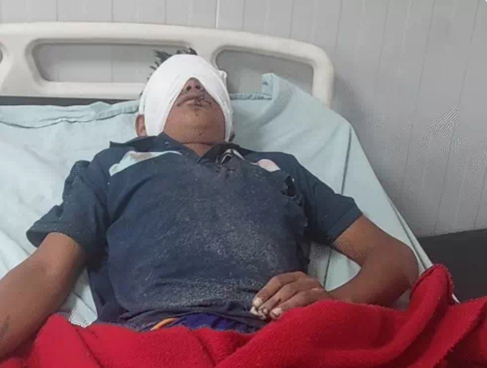 दीपावली की आतिशबाजी से 3 दिनों में 100 से ज्यादा लोग झुलसेः पोटाश की चपेट में आने से तीन घायल